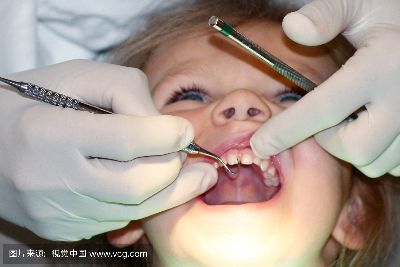 德国CEREC（瓷睿刻）全瓷 颗